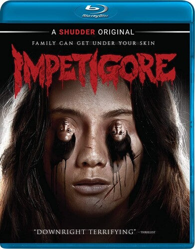Impetigore Bd