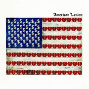 American Lesion - Blue