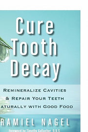 Cure Tooth Decay: Remineralize Cavities and Repair Your Teeth Naturally with Good Food by Nagel, Ramiel