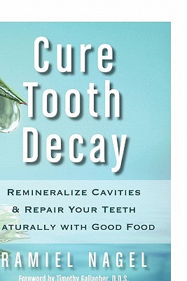 Cure Tooth Decay: Remineralize Cavities and Repair Your Teeth Naturally with Good Food -- Ramiel Nagel, Paperback