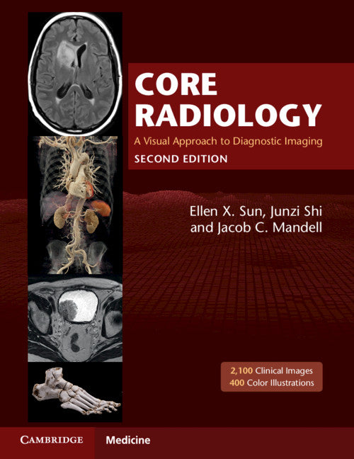 Core Radiology: A Visual Approach to Diagnostic Imaging -- Ellen X. Sun, Paperback
